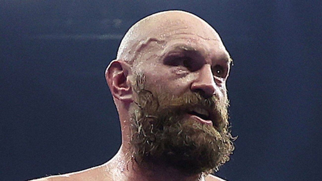 skysports-tyson-fury-oleksandr_6783005.jpg