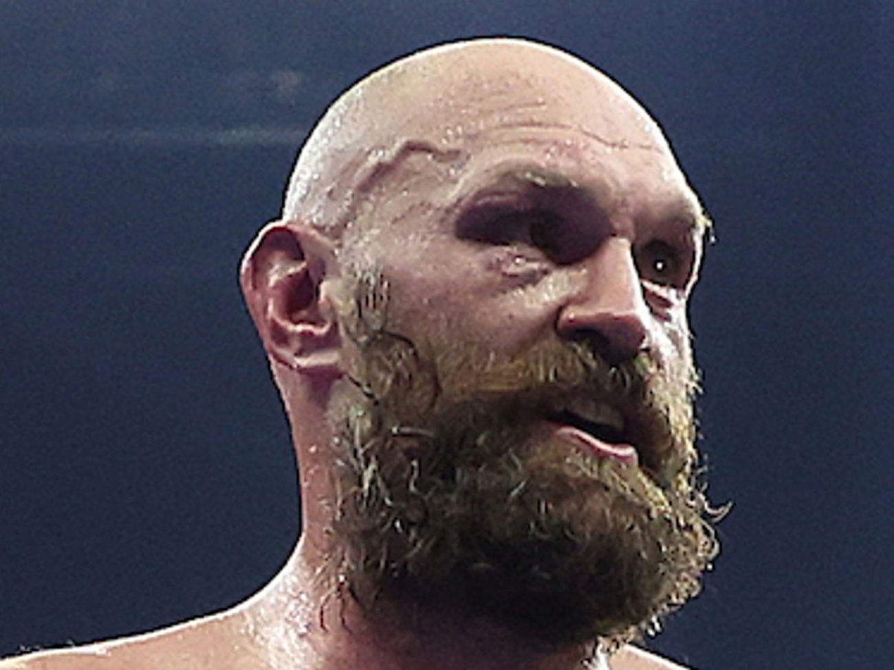 skysports-tyson-fury-oleksandr_6783005.jpg